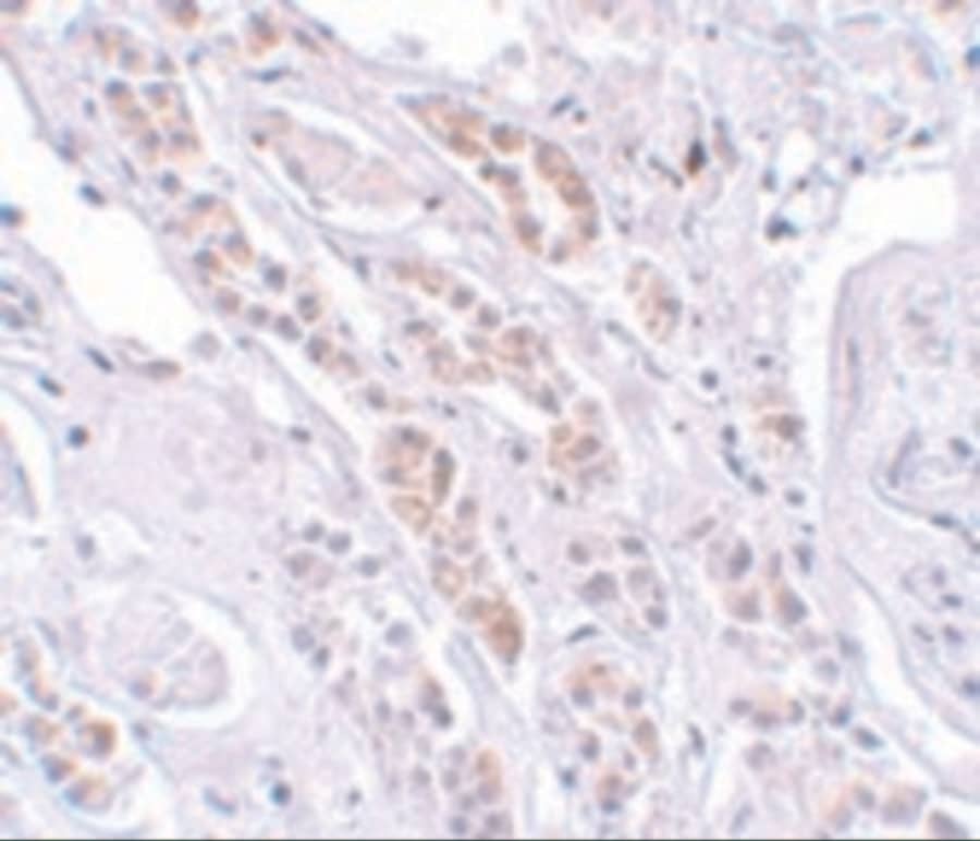 TCTN1 Antibody - BSA Free