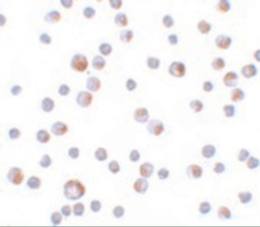 TCTN3 Antibody - BSA Free