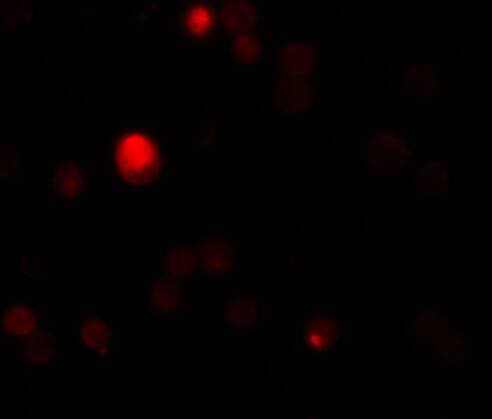 TCTN3 Antibody - BSA Free