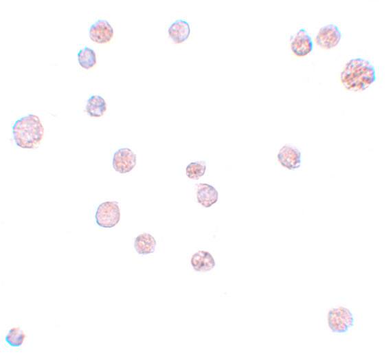 ATP11A Antibody - BSA Free