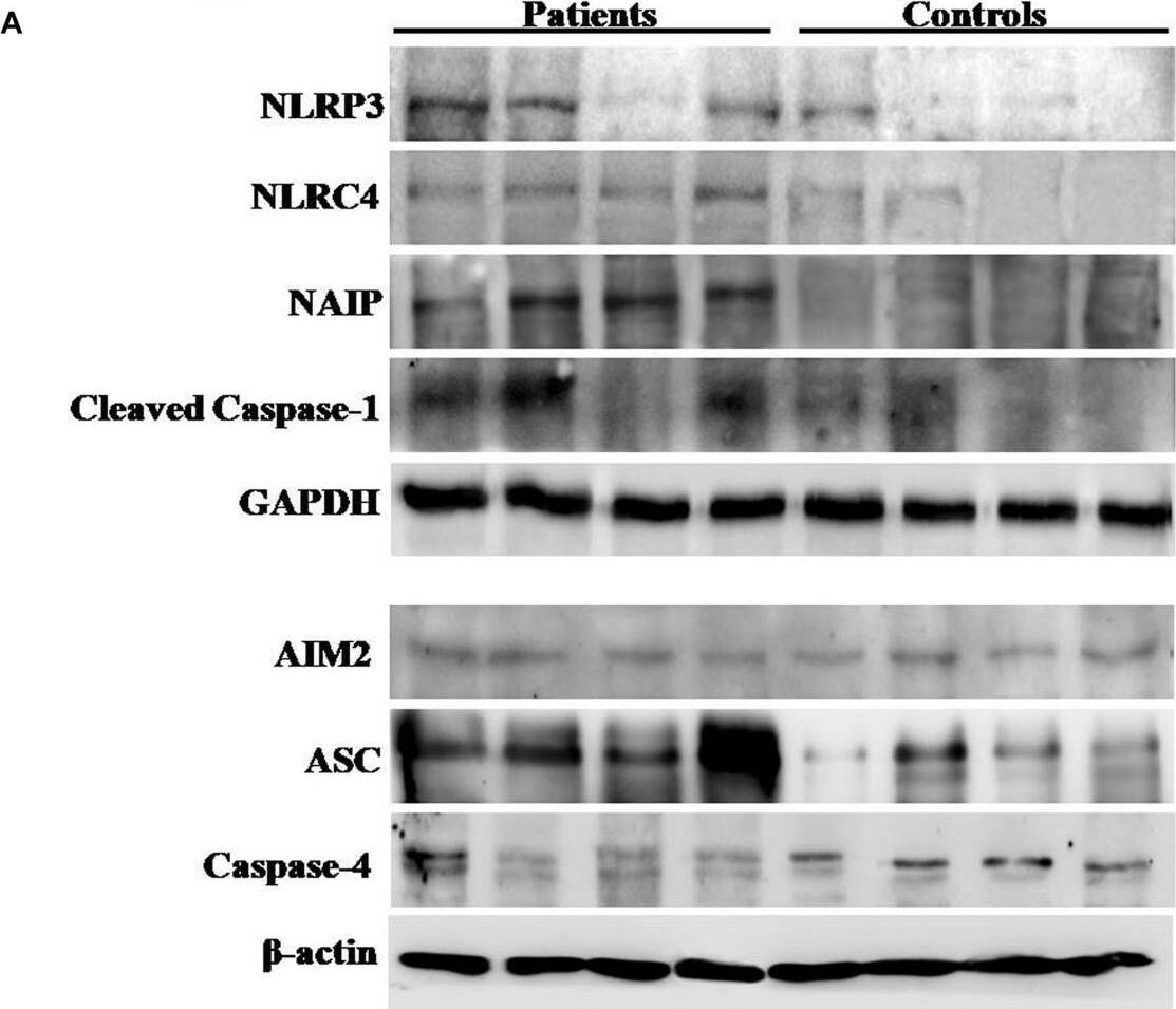 Caspase-4 Antibody - BSA Free