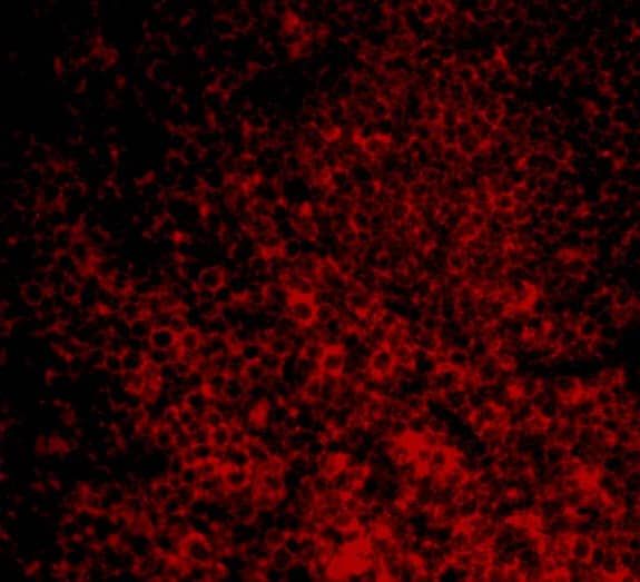 CARD11/CARMA1 Antibody - BSA Free