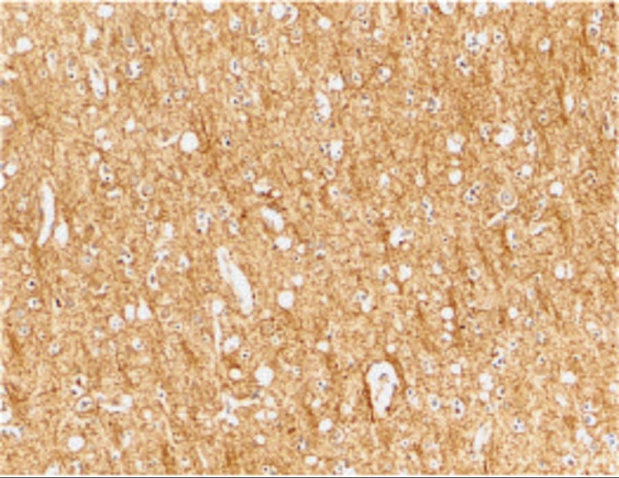 TEM8/ANTXR1 Antibody - BSA Free