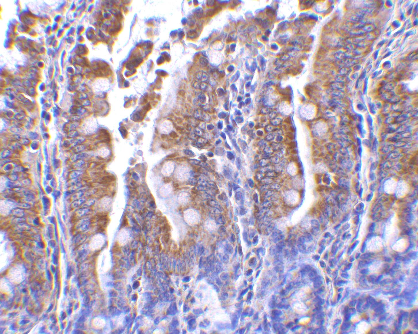 PIST Antibody - BSA Free