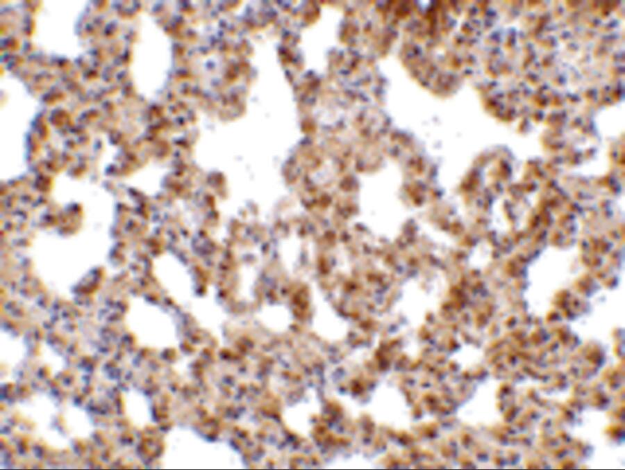 TRPC6 Antibody - BSA Free