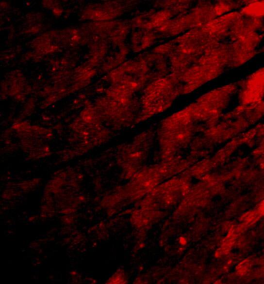 TRPC3 Antibody - BSA Free