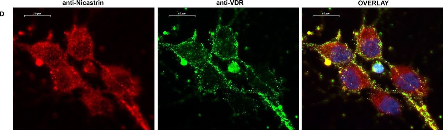 Nicastrin Antibody - BSA Free