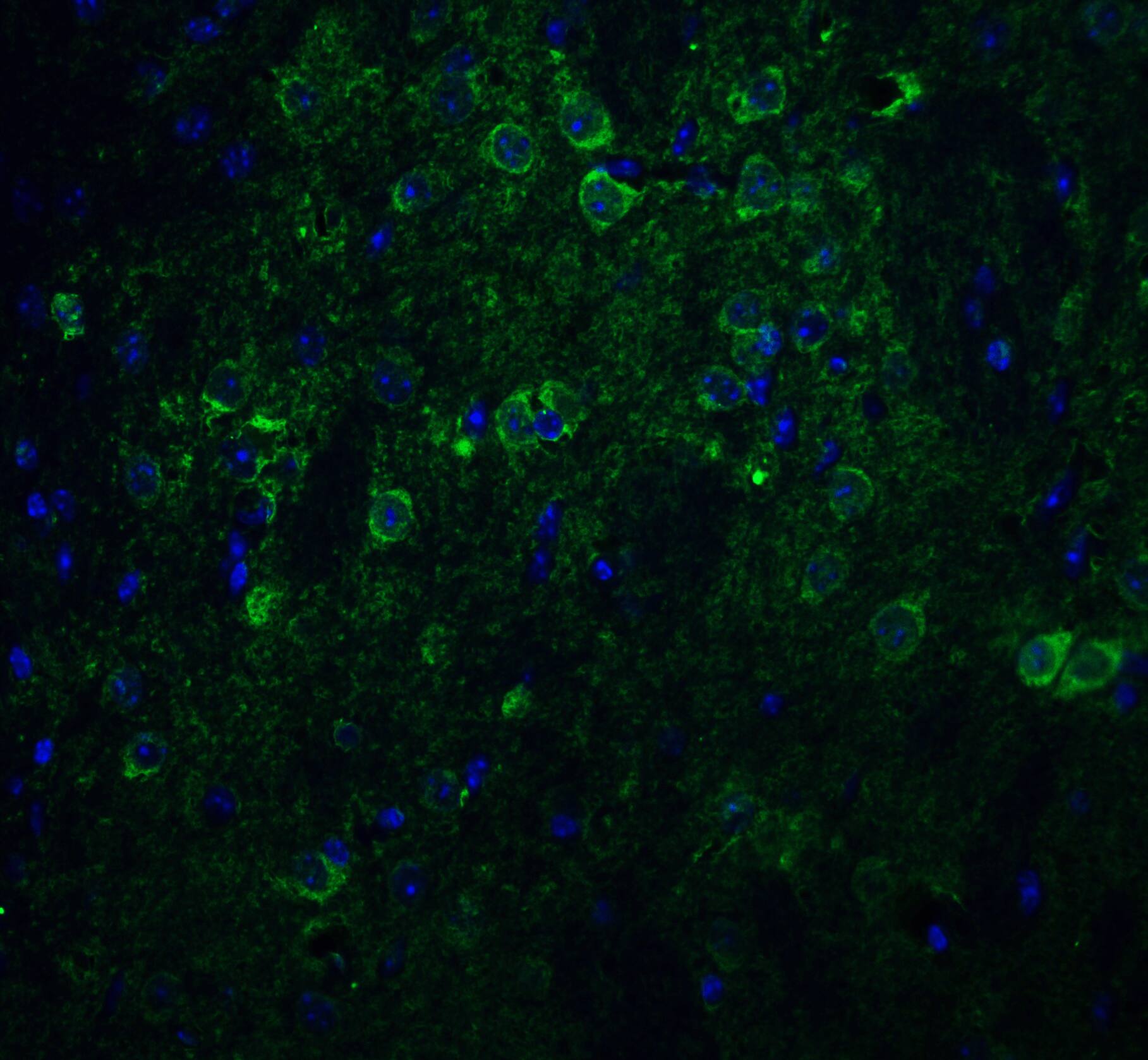 Nicastrin Antibody - BSA Free