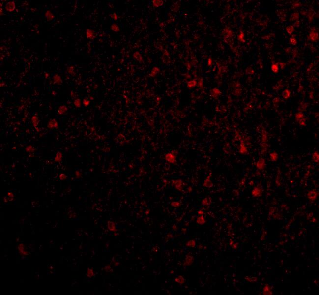 BRSK2 Antibody - BSA Free