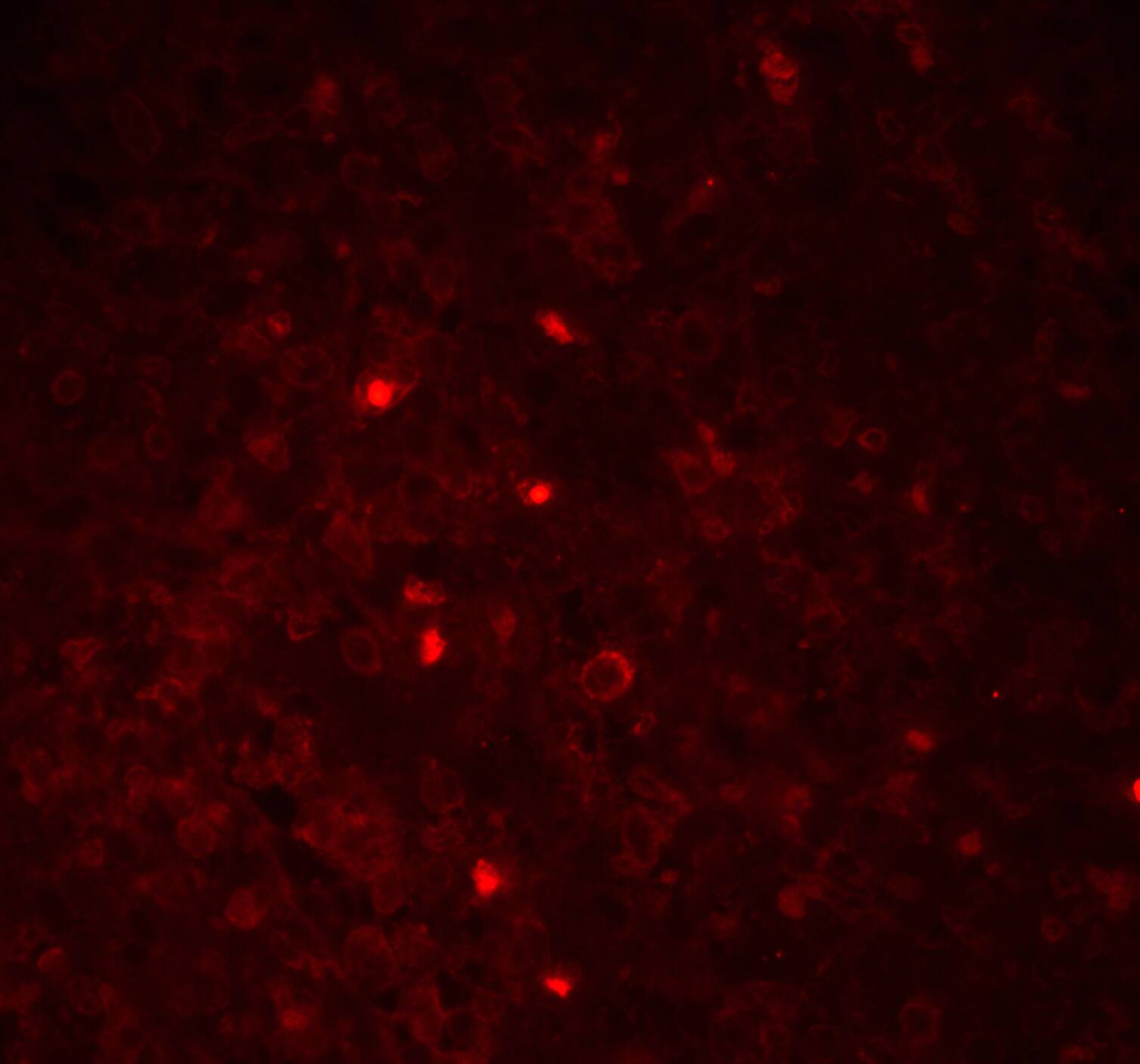 ASC/TMS1 Antibody - BSA Free