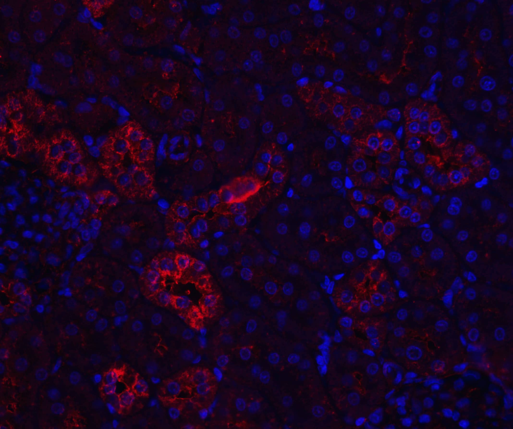 Nephrin Antibody - BSA Free