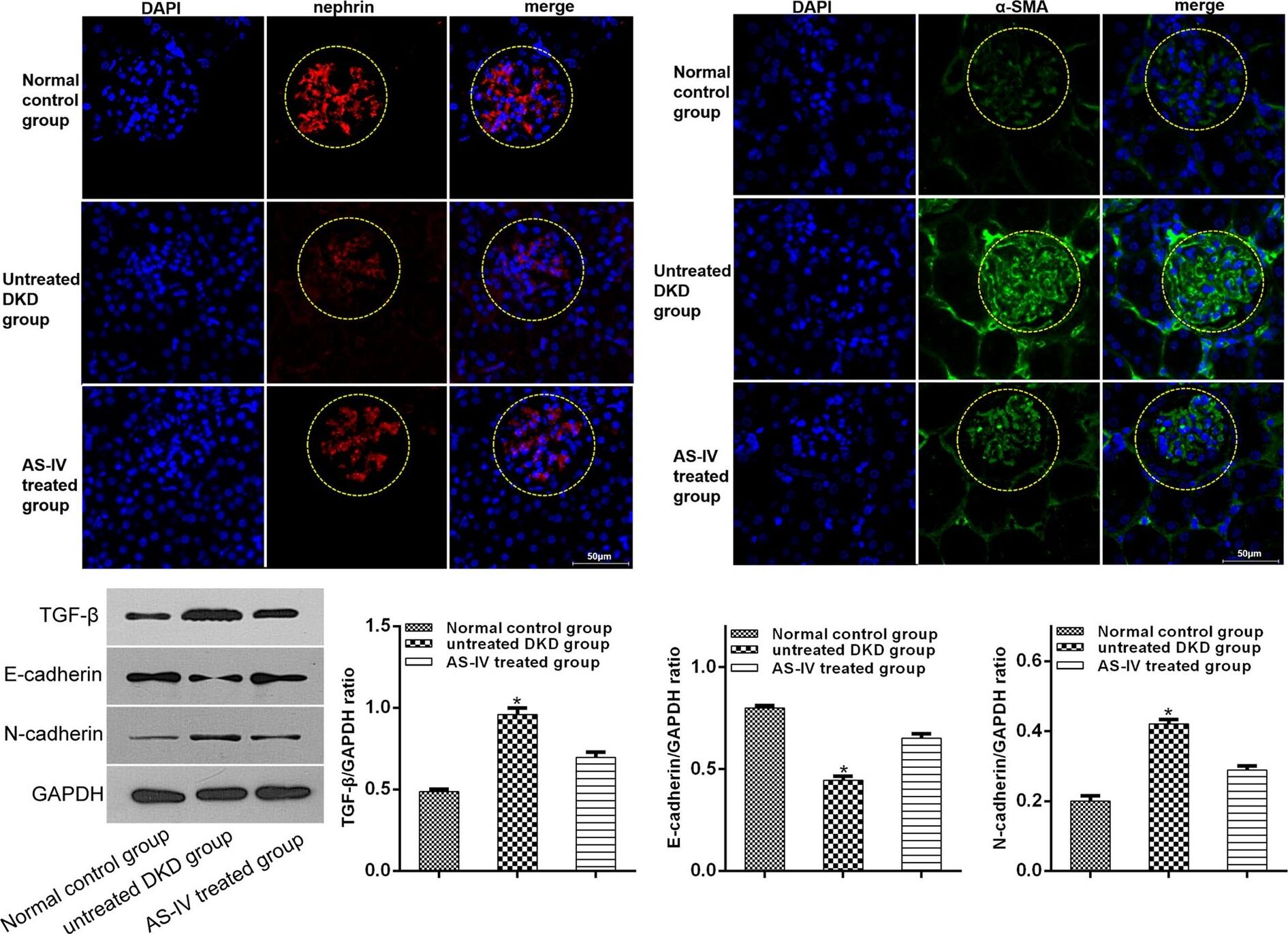 Nephrin Antibody - BSA Free