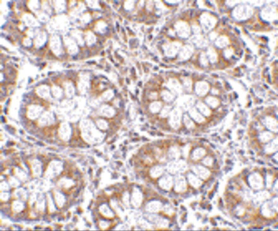Endosialin/CD248/TEM1 Antibody - BSA Free