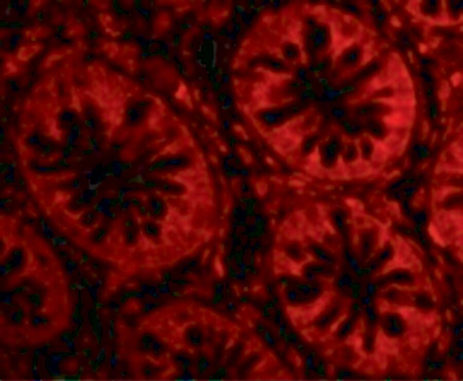 Endosialin/CD248/TEM1 Antibody - BSA Free