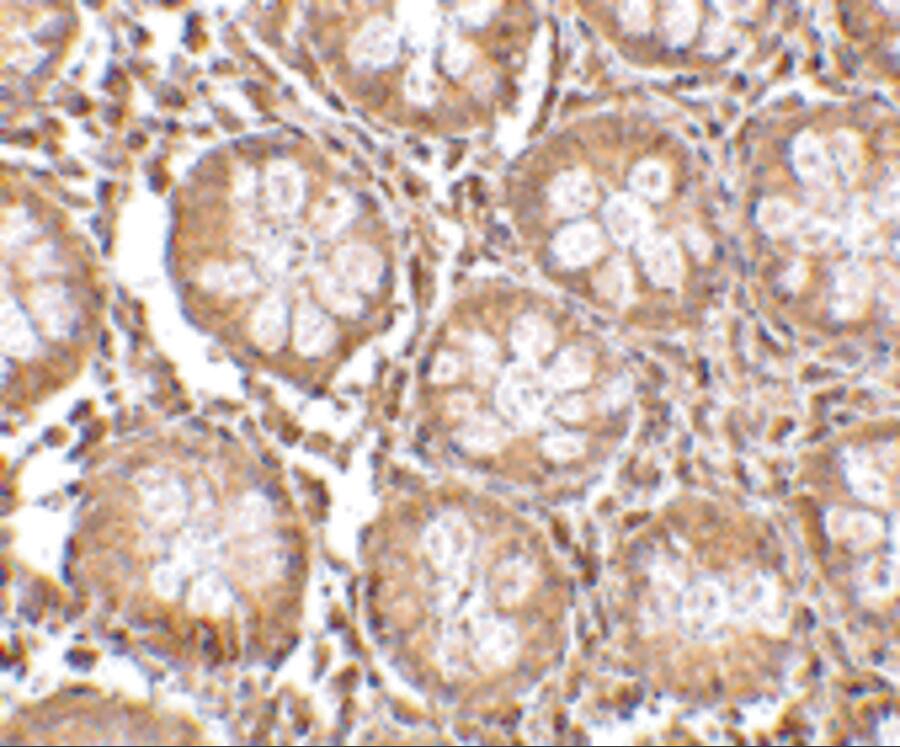 Endosialin/CD248/TEM1 Antibody - BSA Free