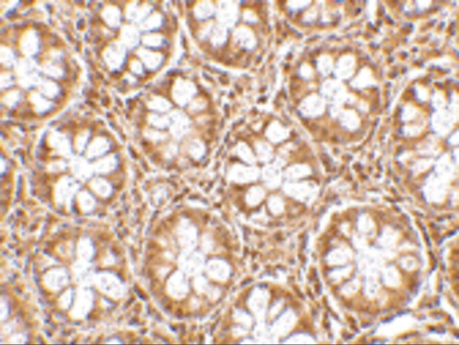 RASD2 Antibody - BSA Free