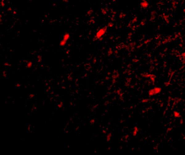 FBXL20 Antibody - BSA Free