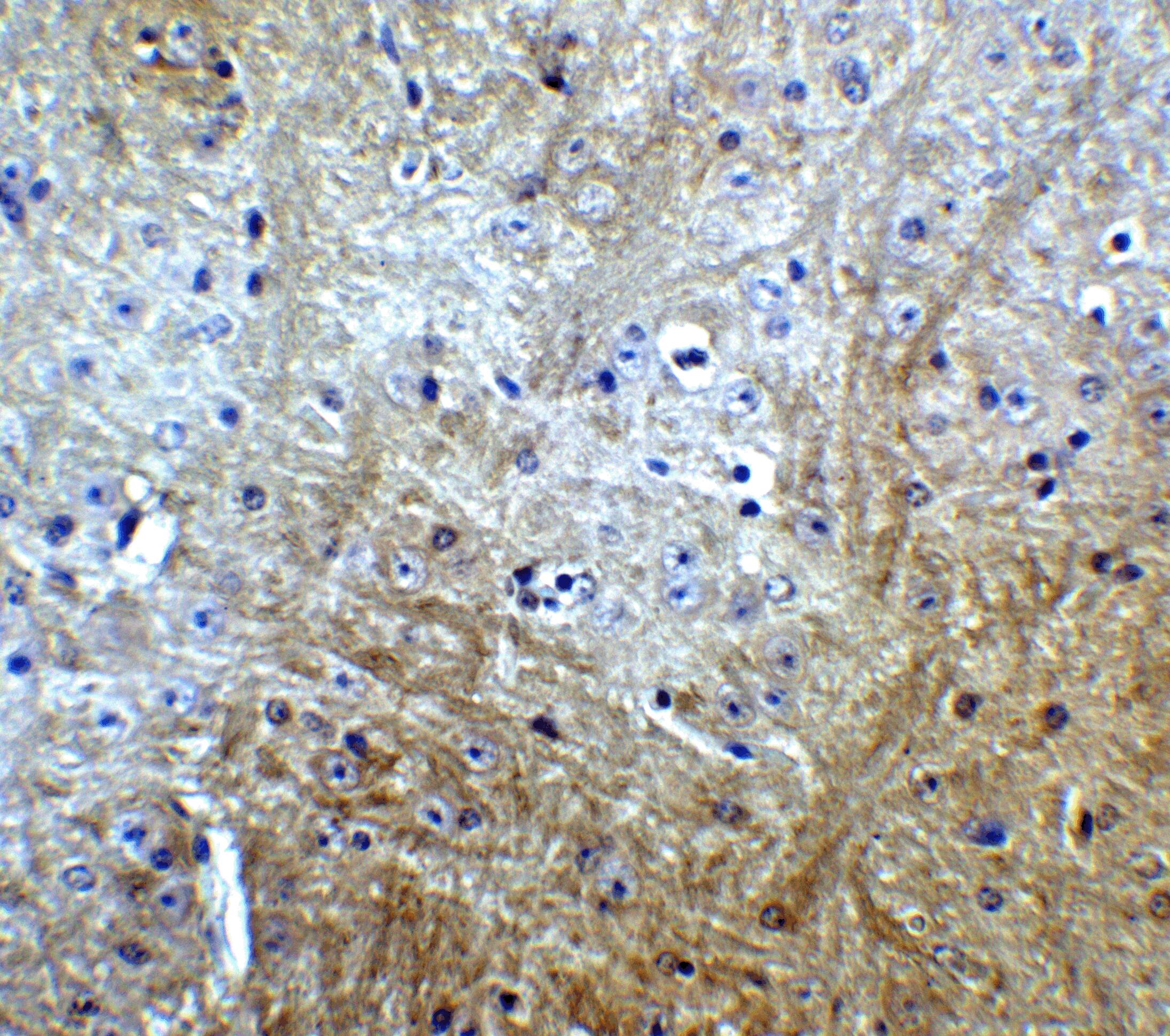 SLITRK1 Antibody - BSA Free