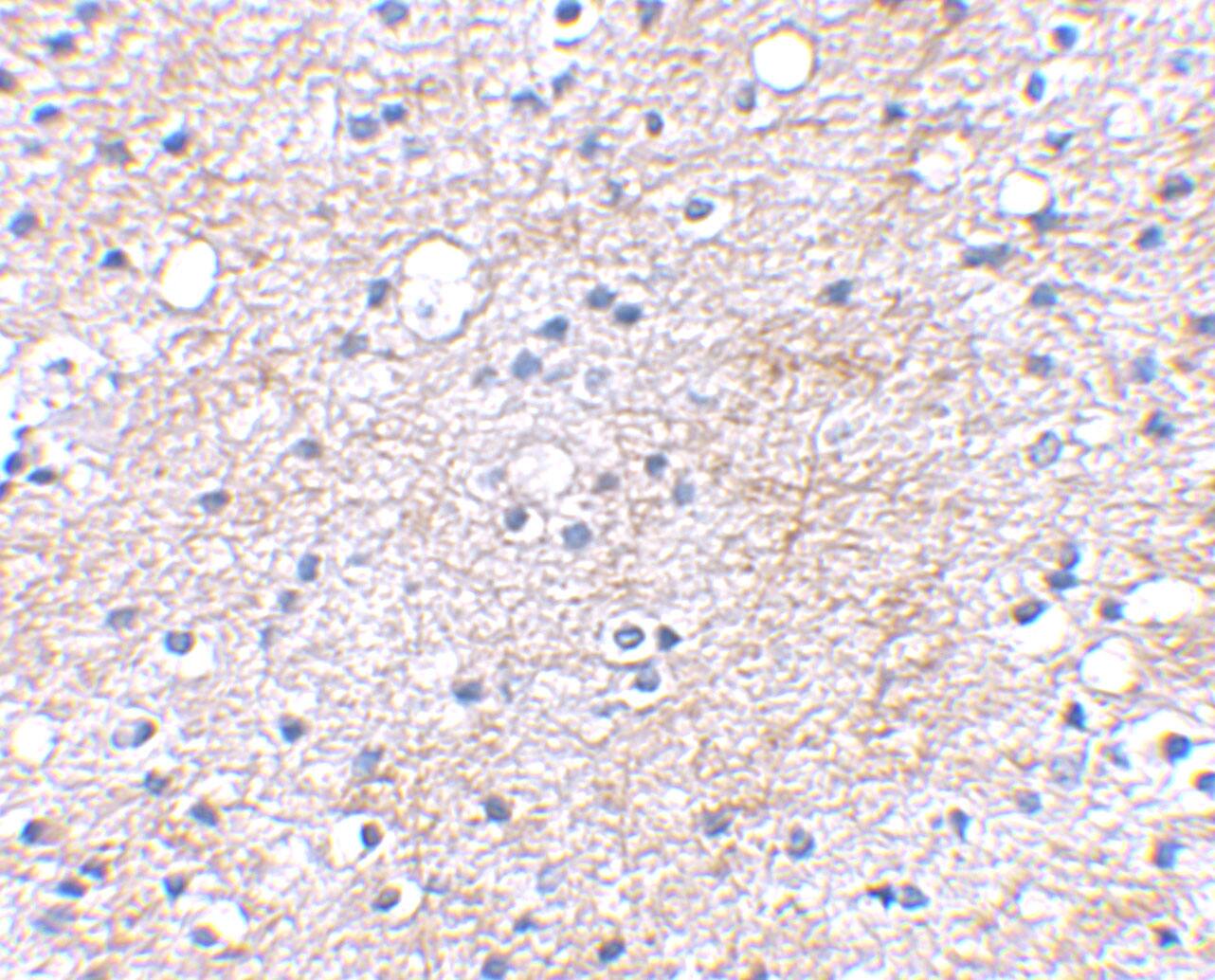 Lgi1 Antibody - BSA Free
