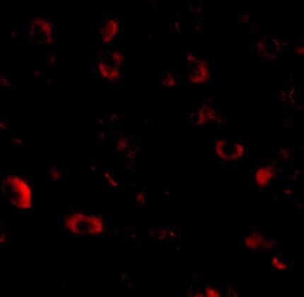 CADPS Antibody - BSA Free