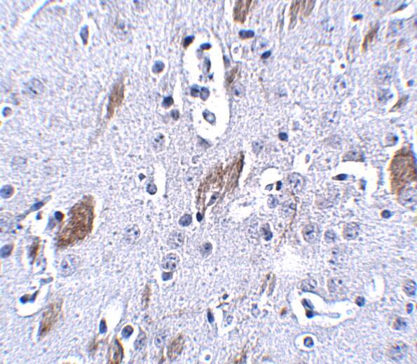 ATOH8 Antibody - BSA Free
