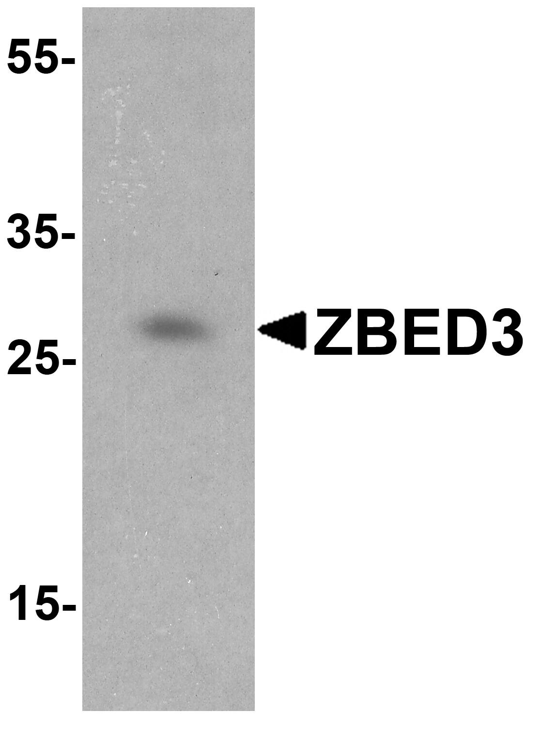 ZBED3 Antibody Blocking Peptide