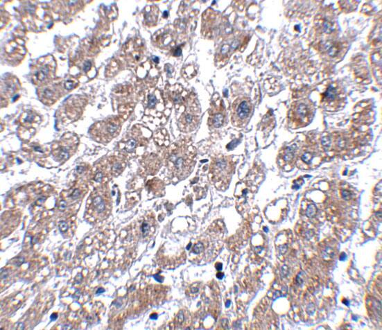 Matrilin-1 Antibody - BSA Free