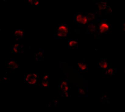 KLHL15 Antibody - BSA Free