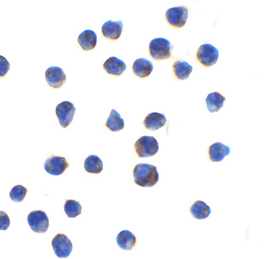 AGTR-2 Antibody - BSA Free