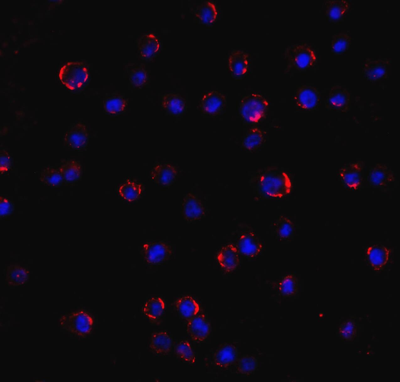 AGTR-2 Antibody - BSA Free