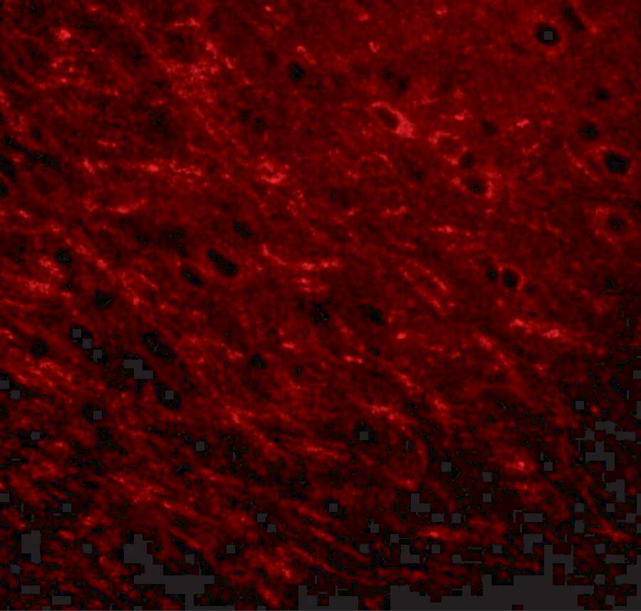 ProSAPiP1 Antibody - BSA Free