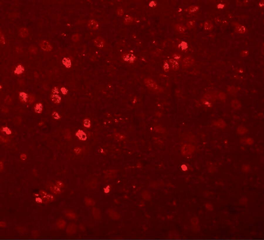 Synaptogyrin 1 Antibody - BSA Free