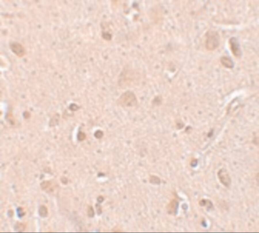 TINP1 Antibody - BSA Free