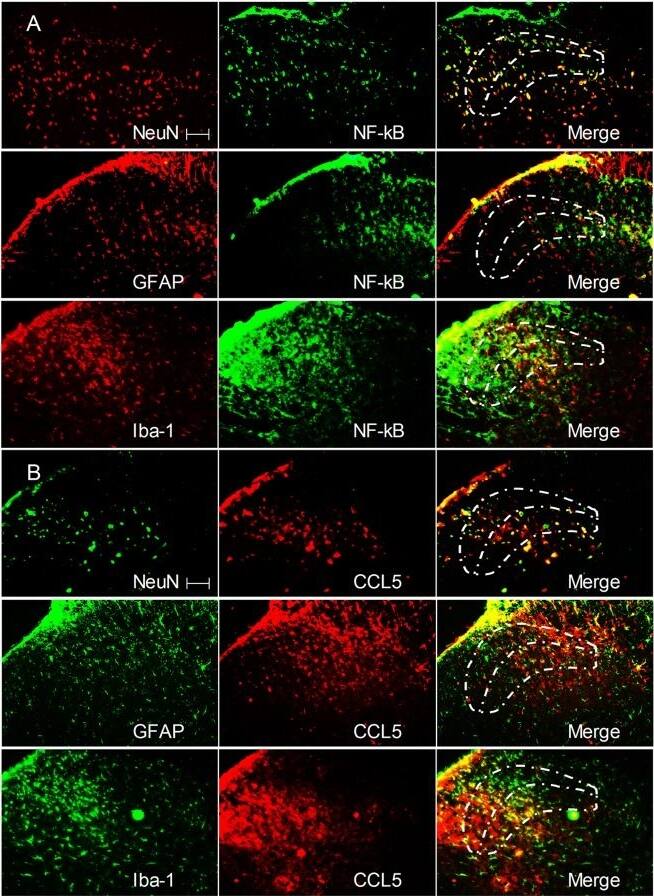 Rbfox3neun Antibody Bsa Free Nbp1 77686 Bio Techne 7775