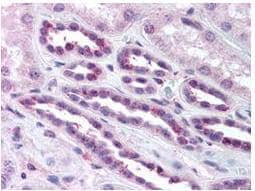 RelA/NFkB p65 [p Ser276] Antibody