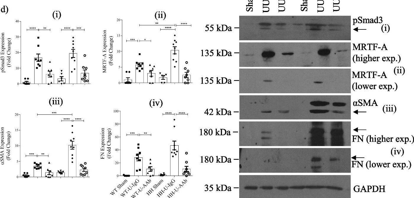Smad3 [p Ser423, p Ser425] Antibody - BSA Free