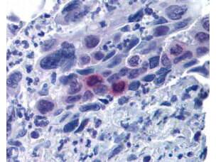 MLF1 Interacting Protein [p Thr78] Antibody