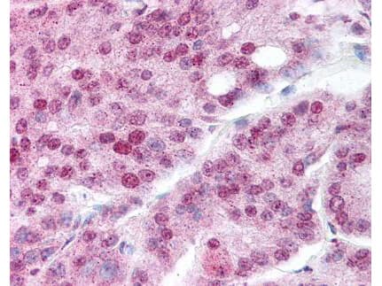 HSP90 alpha [ac Lys294] Antibody