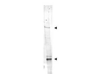 NIPBL Antibody