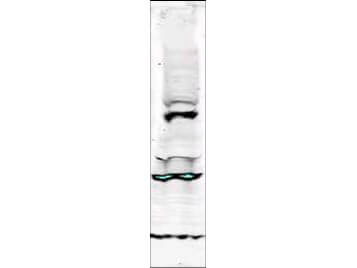 TLK1 Antibody