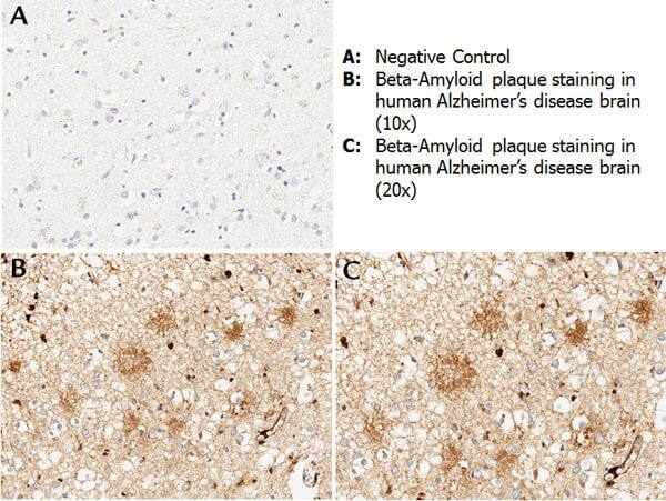 beta Amyloid Antibody