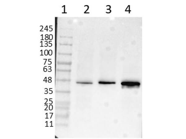 beta Amyloid Antibody