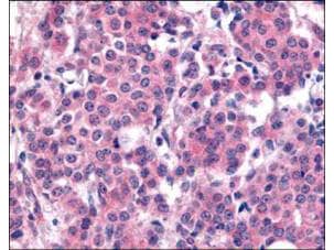 PLK1 [p Thr210] Antibody