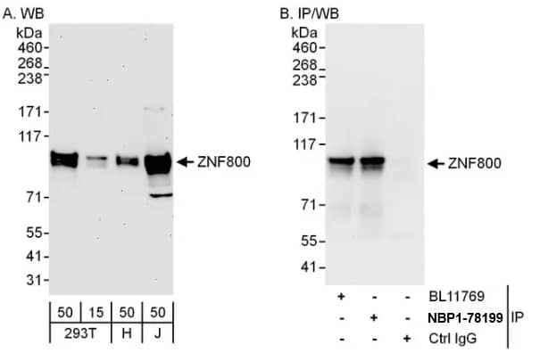 Western Blot: ZNF800 Antibody [NBP1-78199]