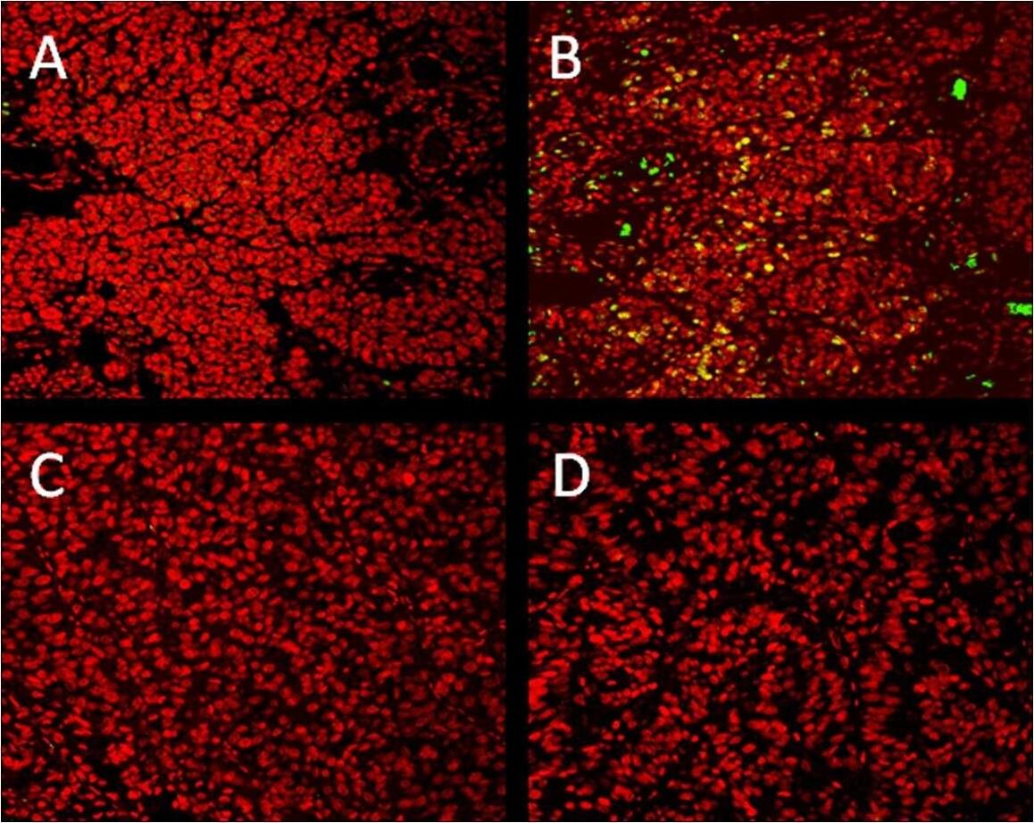 GLI-1 Antibody - BSA Free