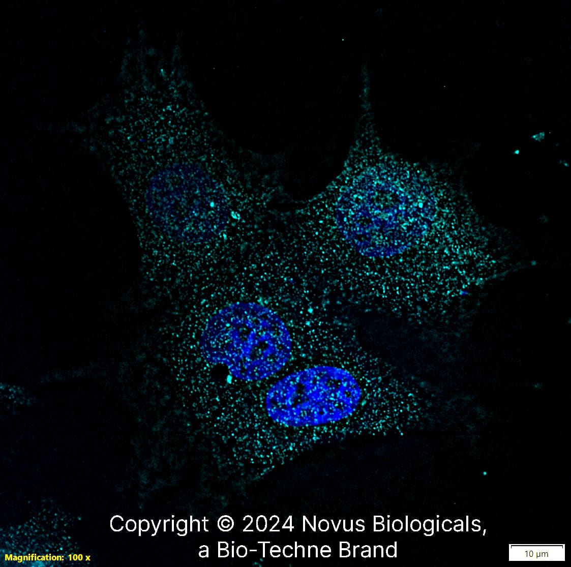 PIEZO1 Antibody [DyLight 650]