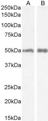 Histamine H2R Antibody