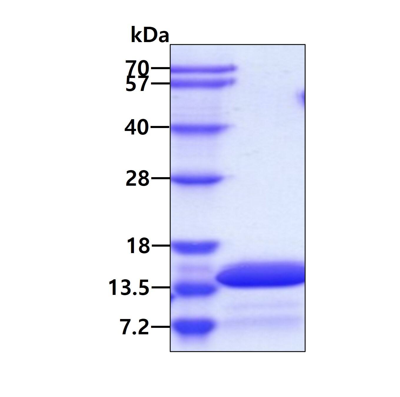 Recombinant Human Kidney-associated antigen 1 His Protein