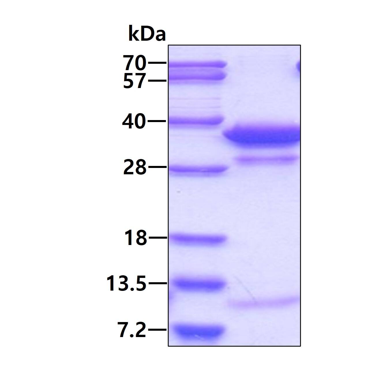 Recombinant Human LHPP His Protein SDS-Page: Recombinant Human LHPP Protein [NBP1-78818]