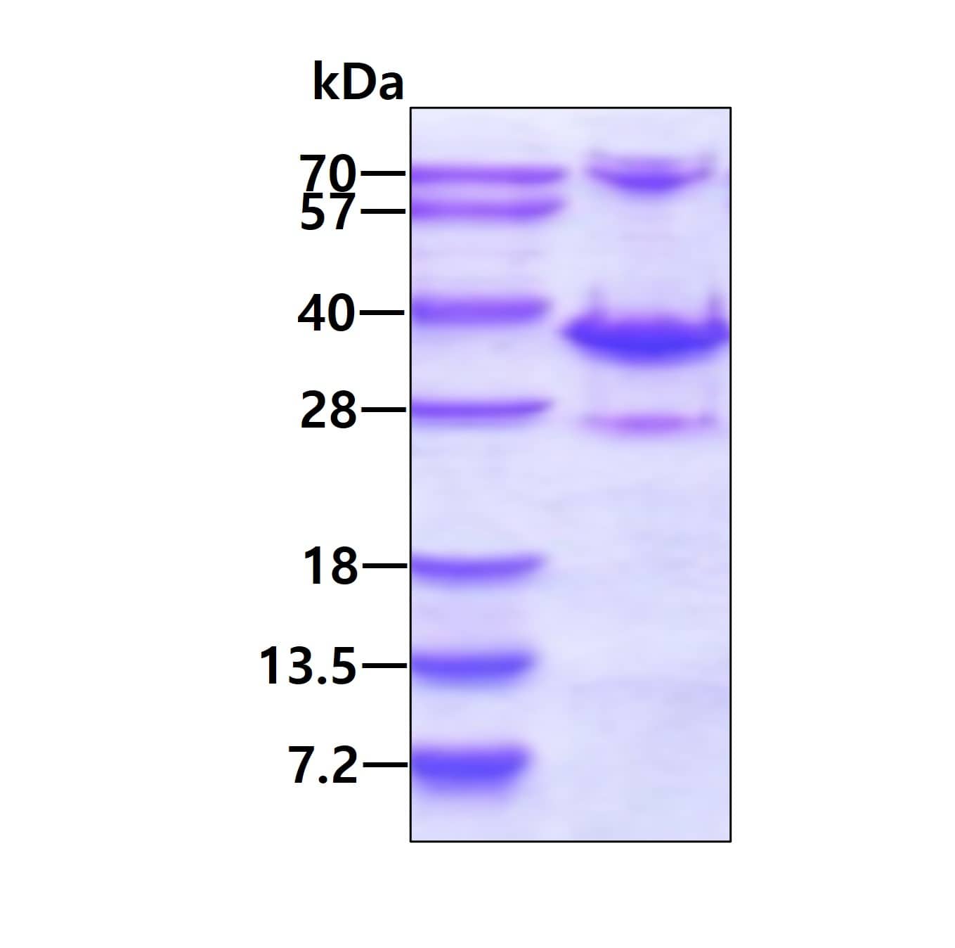 Recombinant Human DHRS4 His Protein